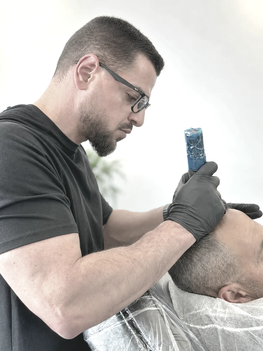 Scalp micropigmentation treatment in progress